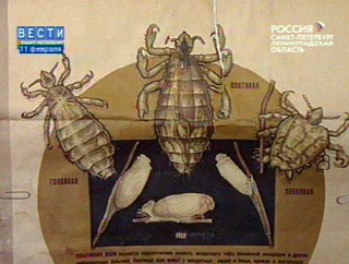 В Петербурге вспышка педикулёза