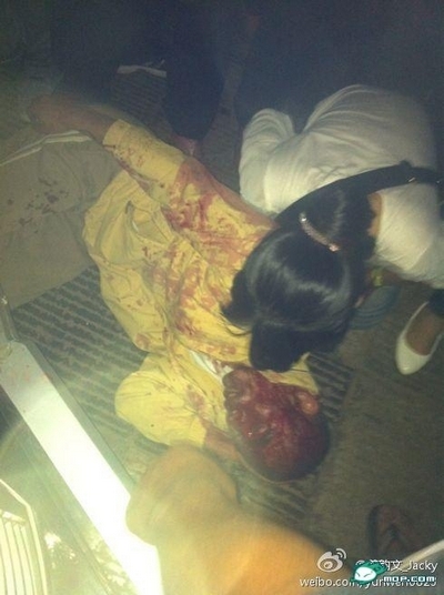 Избитый полицейскими крестьянин-торговец овощами. Город Куньминь провинции Юньнань. Сентябрь 2011 года. Фото с epochtimes.com