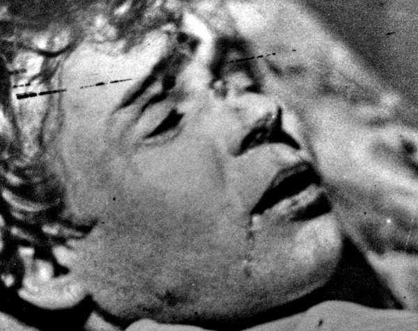 Сергей Есенин на кушетке, в гостинице, тело приведено в порядок и лицо заретушировано. Фото с сайта esenin.ru