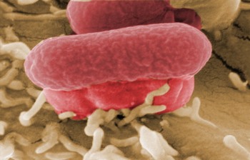 Кишечная инфекция E.coli. Фото:PIERRE VERDY/AFP/Getty Images 