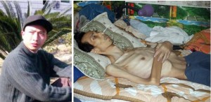 Последователь Фалуньгун Чэнь Цзяньчжун до и после пыток в заключении в Китае