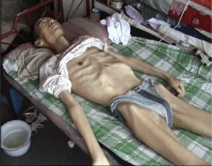 Последователь Фалуньгун Ли Ваньюнь до и после пыток в заключении в Китае