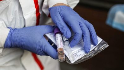 Лекарство от язвы эффективно против вируса COVID-19, обнаружили гонконгские учёные