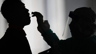 Шелушение кожи, опухший язык, отёки рук и ног. Выявлены новые симптомы вируса COVID-19