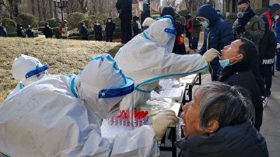 76% пациентов с COVID-19 проявляют симптомы даже спустя полгода после выздоровления