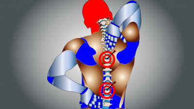 Остеохондроз: причины, виды, лечение