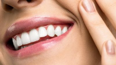 Отбеливание зубов: за и против
