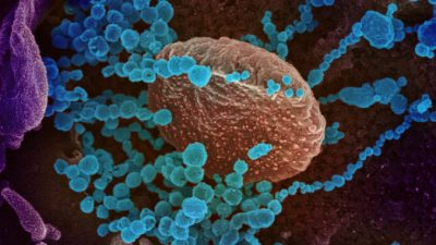 Из-за необычных мутаций COVID-19 штамм «Лямбда» может быть устойчивым к вакцинам