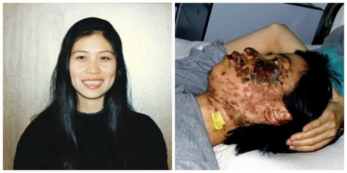 Фалуньгун, пытки, китай Фалуньгун, пытки, китай