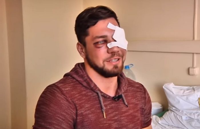 Пострадавший Роман Ковалёв. Скриншот / youtube | Epoch Times Россия