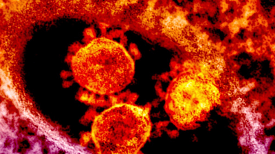 Вероятность госпитализации с «Омикрон» гораздо ниже