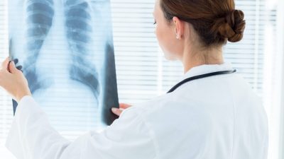 Как вылечить постковидный синдром