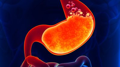 Пять основных причин, по которым нельзя принимать ингибиторы протонной помпы