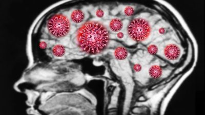 Может ли COVID-19 ухудшить память и привести к когнитивному спаду?