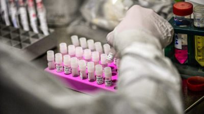 Всё больше стран выявляют случаи заболевания «Дельтакроном»