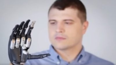 Почему возникает чувство, что удалённый орган болит?