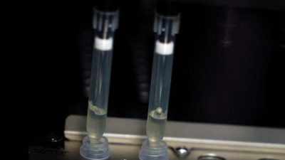 США расширяют тестирование на оспу обезьян по мере роста числа заболевших