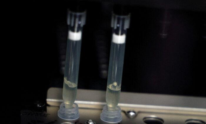 США расширяют тестирование на оспу обезьян по мере роста числа заболевших Образцы в подозреваемых случаев оспы обезьян для тестирования в лаборатории микробиологии в больнице Ла-Пас в Мадриде, Испания, 1 июня 2022 года. Фото: Susana Vera/Reuters
| Epoch Times Россия