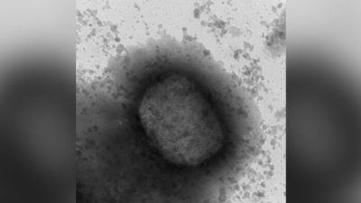 В Канаде подтверждено 168 случаев заболевания оспой обезьян, в том числе 141 в Квебеке