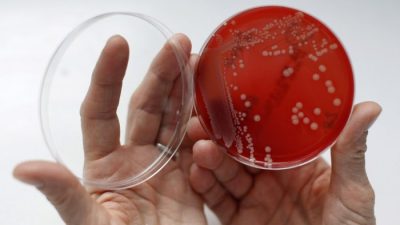 Исследователи в Кембридже бьют тревогу из-за распространения новой бактерии