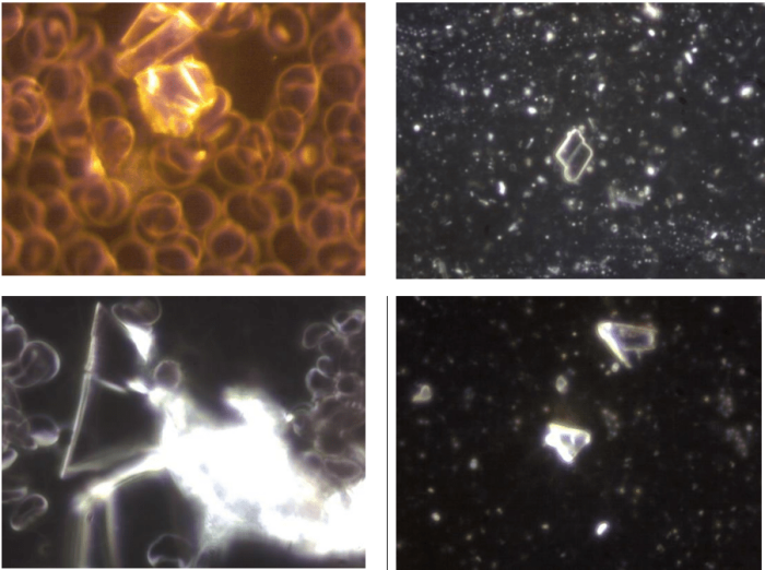 Немецкие учёные обнаружили токсичные металлы в вакцинах от COVID-19 Немецкие учёные обнаружили токсичные металлы в вакцинах от COVID-19