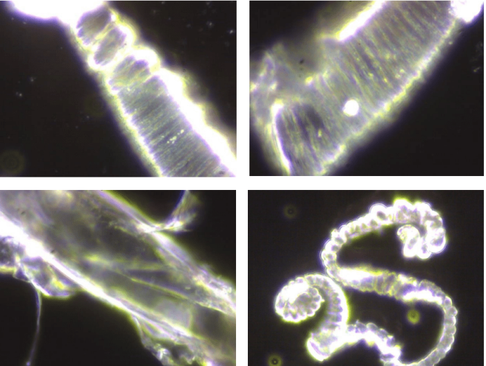 Немецкие учёные обнаружили токсичные металлы в вакцинах от COVID-19 Немецкие учёные обнаружили токсичные металлы в вакцинах от COVID-19