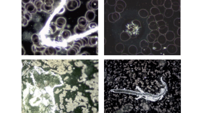 Немецкие учёные обнаружили токсичные металлы в вакцинах от COVID-19
