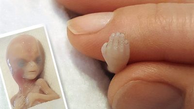 14-недельный ребёнок — это не «медицинские отходы». Вас потрясут эти фотографии