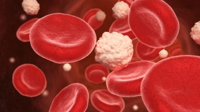 ЭКСКЛЮЗИВ: Признаки тромбоза из-за COVID-19 или вакцины, и что с этим делать