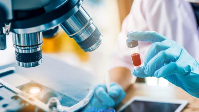 ЭКСКЛЮЗИВ: Почему спайковый белок вызывает аномальные тромбы и 200 симптомов. Часть 2