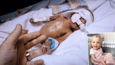 Ребёнок, родившийся на 16 недель раньше срока, теперь счастливый двухлетний малыш